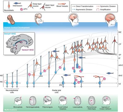 Cortical Malformations: Lessons in Human Brain Development